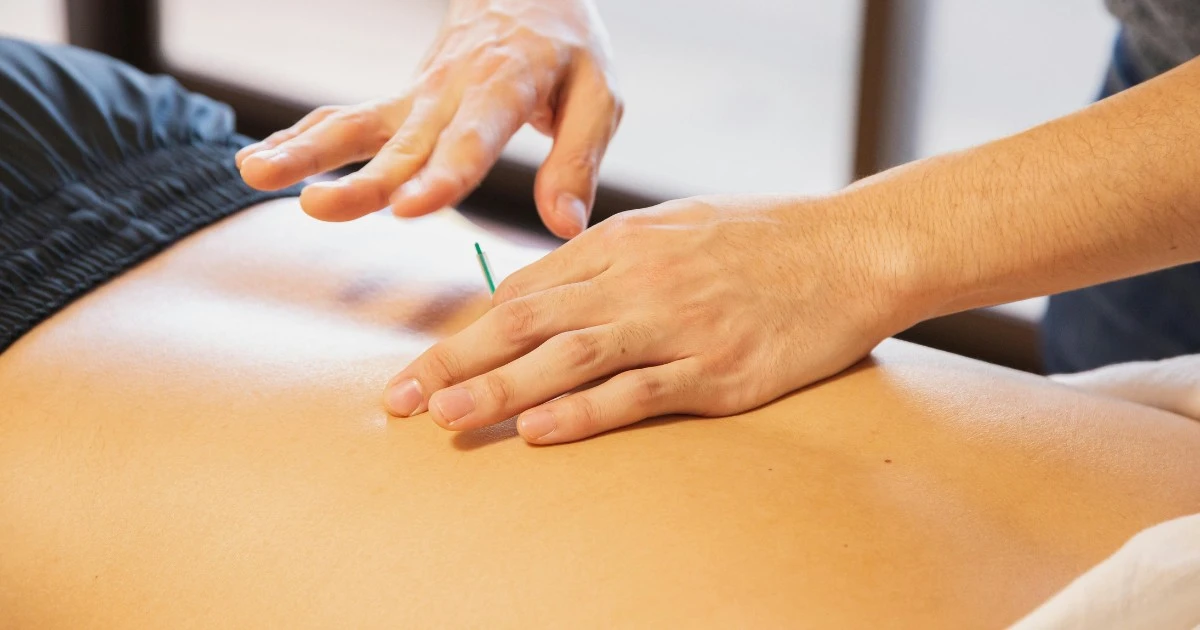 Dry Needling In Flagstaff